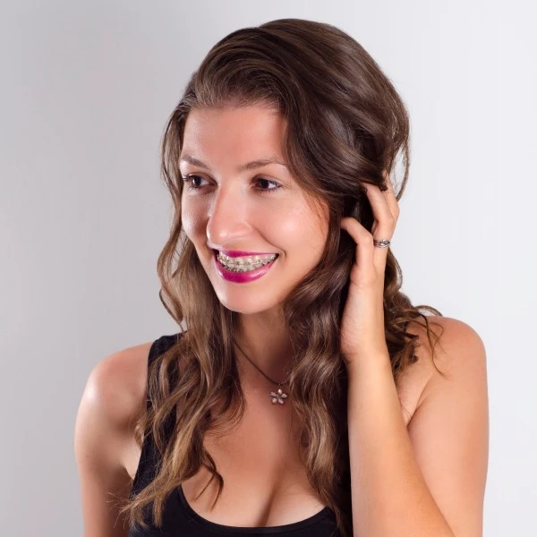 Rose Gold Colored Braces